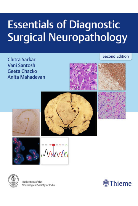 Essentials of Diagnostic Surgical Neuropathology