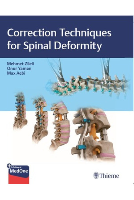 Correction Techniques for Spine Deformity