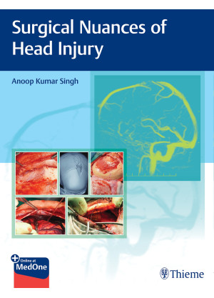 Surgical Nuances of Head Injury