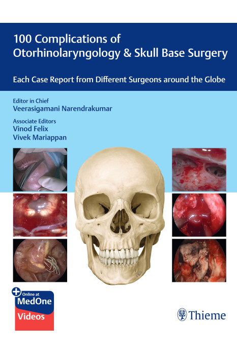 100 Complications of Otorhinolaryngology & Skull Base Surgery