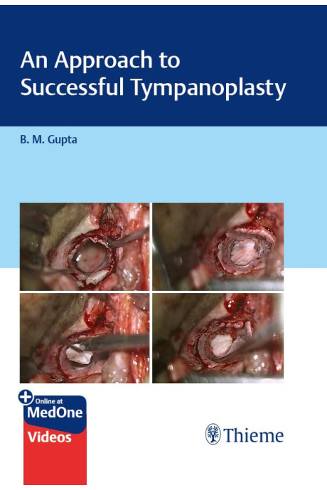 An Approach to Successful Tympanoplasty