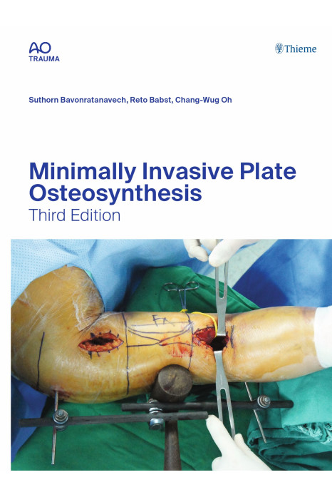 Minimally Invasive Plate Osteosynthesis