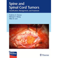 Spine and Spinal Cord Tumors