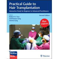 Practical Guide to Hair Transplantation