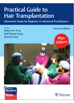 Practical Guide to Hair Transplantation