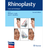 Rhinoplasty