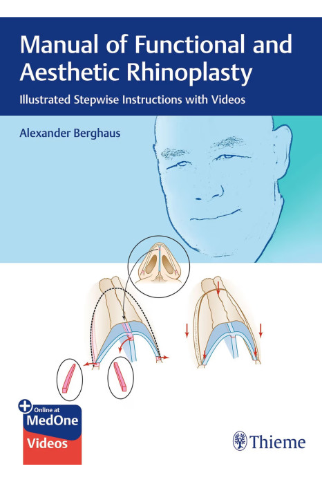 Manual of Functional and Aesthetic Rhinoplasty