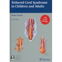Tethered Cord Syndrome in Children and Adults