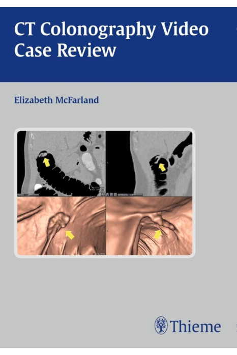CT Colonography Video Case Review