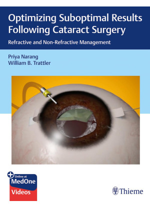 Optimizing Suboptimal Results Following Cataract Surgery