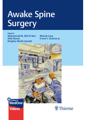 Awake Spine Surgery