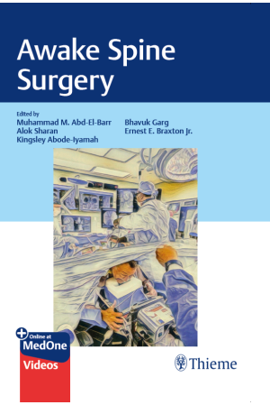 Awake Spine Surgery