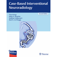 Case-Based Interventional Neuroradiology