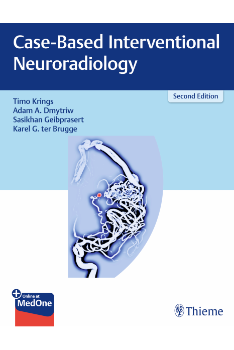 Case-Based Interventional Neuroradiology