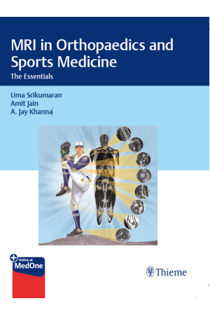MRI in Orthopaedics and Sports Medicine