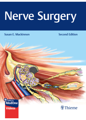 Nerve Surgery