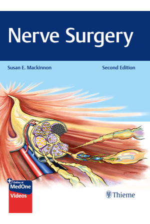 Nerve Surgery