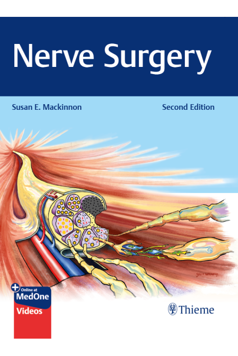 Nerve Surgery