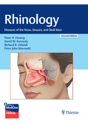 Rhinology : Diseases of the Nose, Sinuses, and Skull Base 2nd Ed.