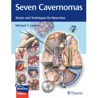 Seven Carvernomas
