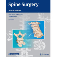 Spine Surgery