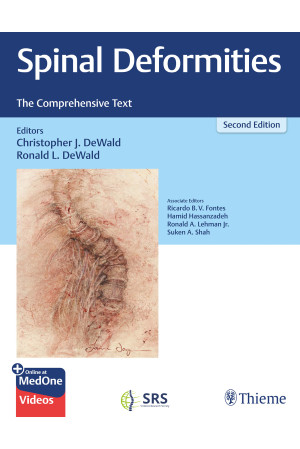 Spinal Deformities The Comprehensive Text