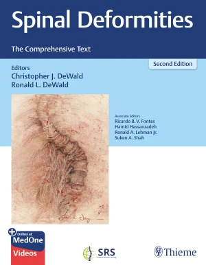 Spinal Deformities The Comprehensive Text