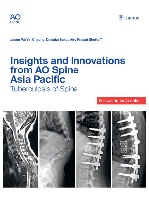 Insights and Innovations from AO Spine Asia Pacific: TB Spine