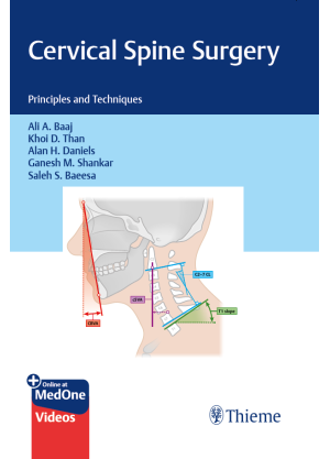 Cervical Spine Surgery