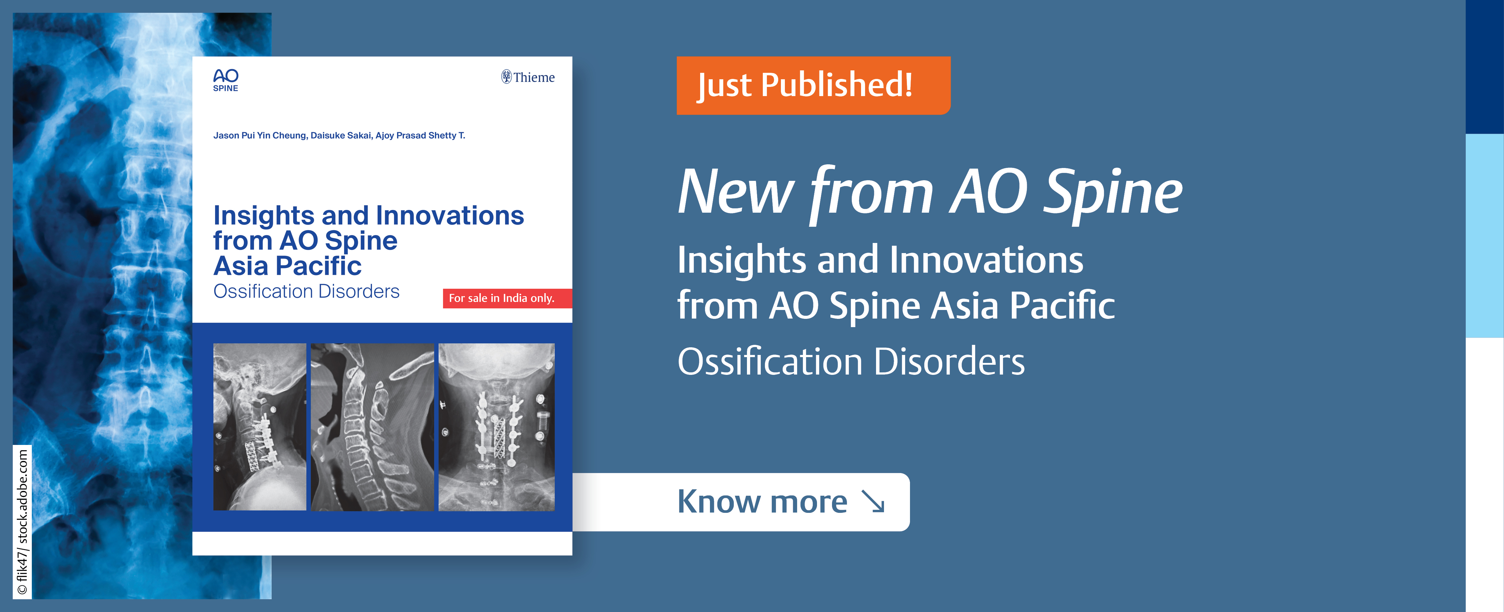 AO Spine New- Ossification Disorder
