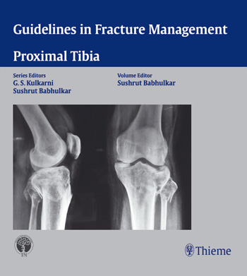 Guidelines in Fracture Management