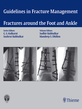Guidelines in Fracture Management