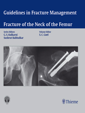 Guidelines in Fracture Management