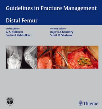 Guidelines in Fracture Management