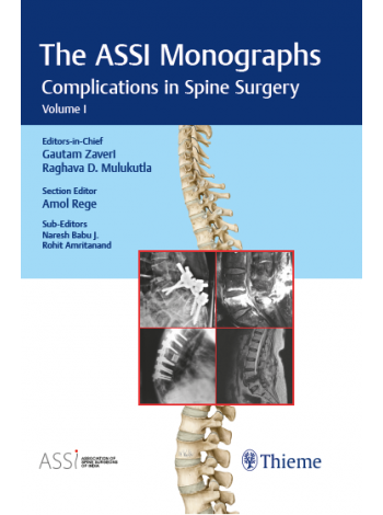 The ASSI Monographs-Complications in Spine Surgery