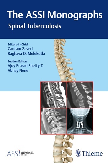 The ASSI Monographs—Spinal Tuberculosis