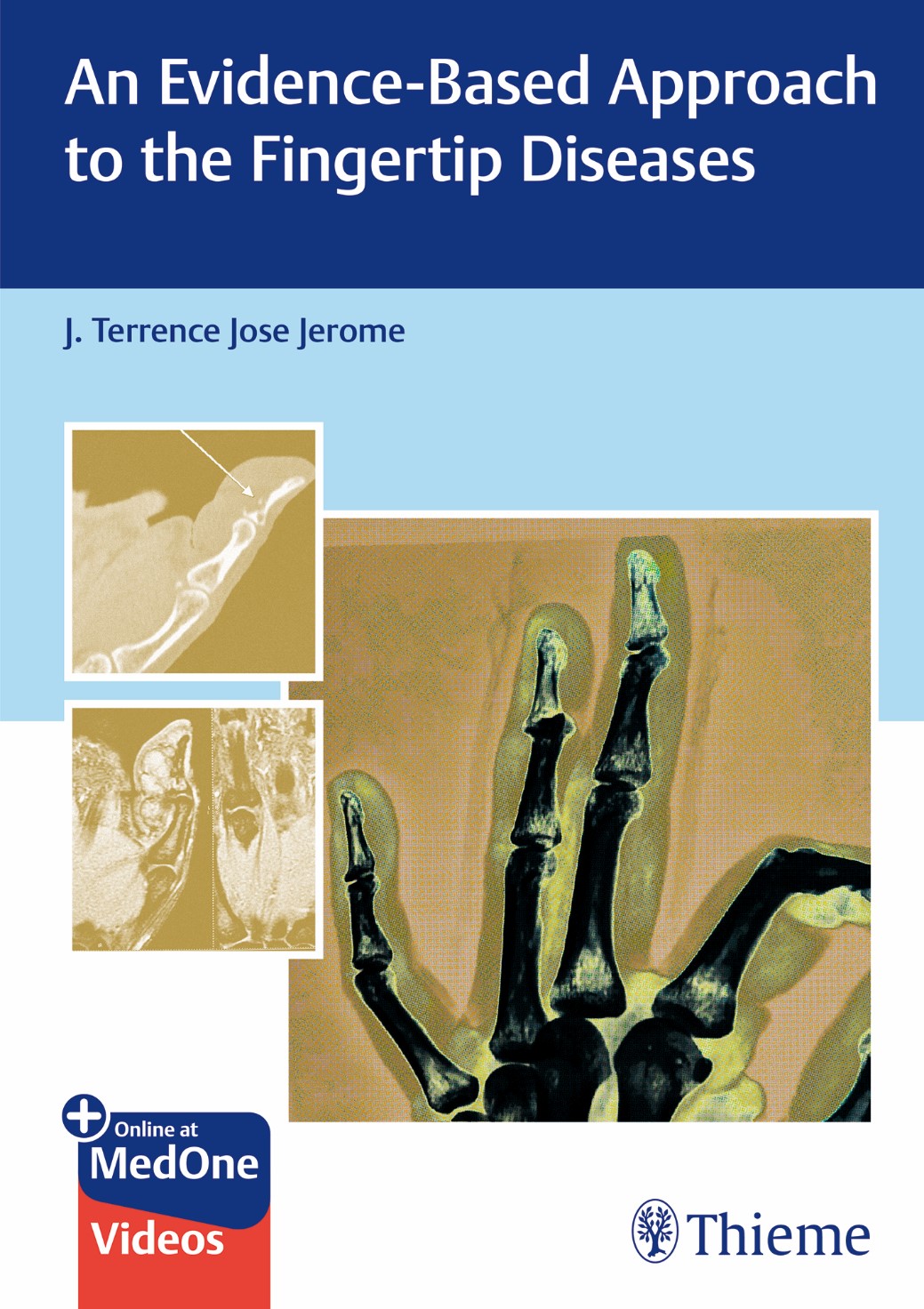 An Evidence-Based Approach To The Fingertip Diseases