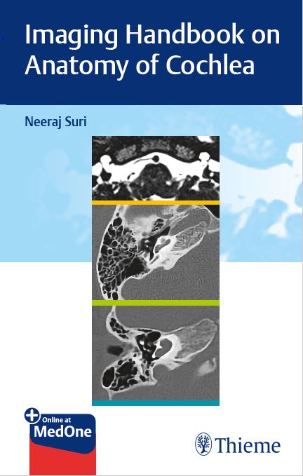 Imaging Handbook on Anatomy of Cochlea
